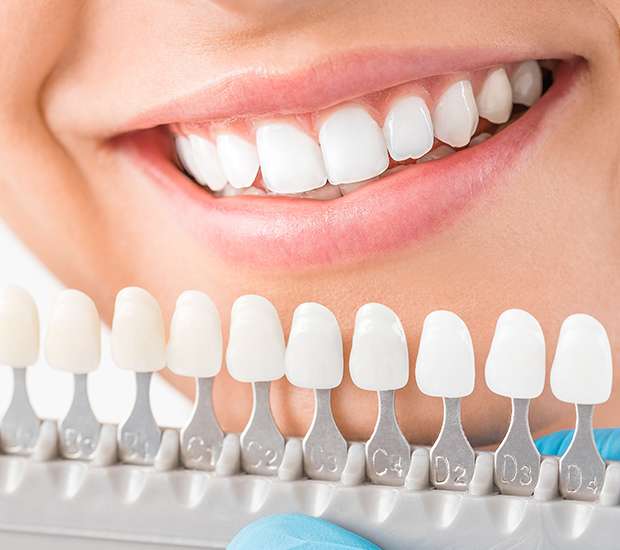 Fresno Cosmetic Dentist