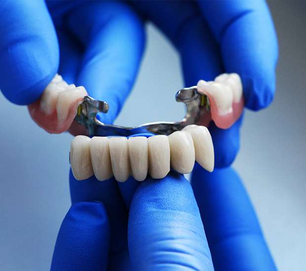 Fresno Dental Bridges