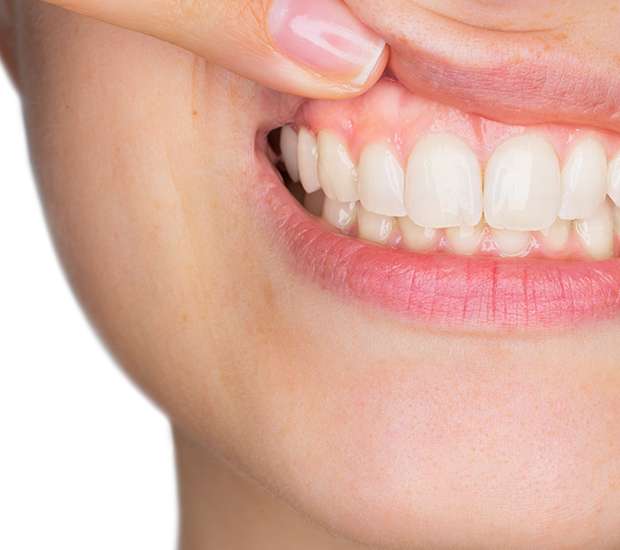 Gum Disease Fresno, CA